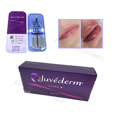 Juvederm Ultra4 피부 필러 입술 필러 얼굴 리프팅 하 젤 주입