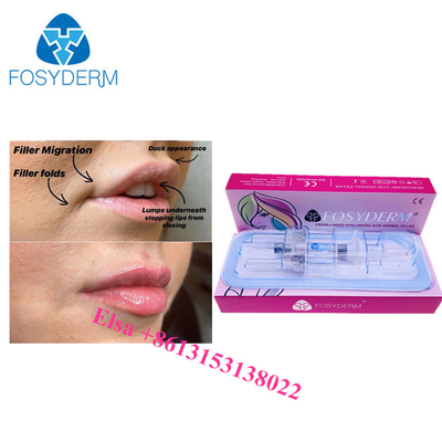 입술 턱 및 코 턱 피부 필러 히알루론산 Ha 주입 1ml 2ml 5ml